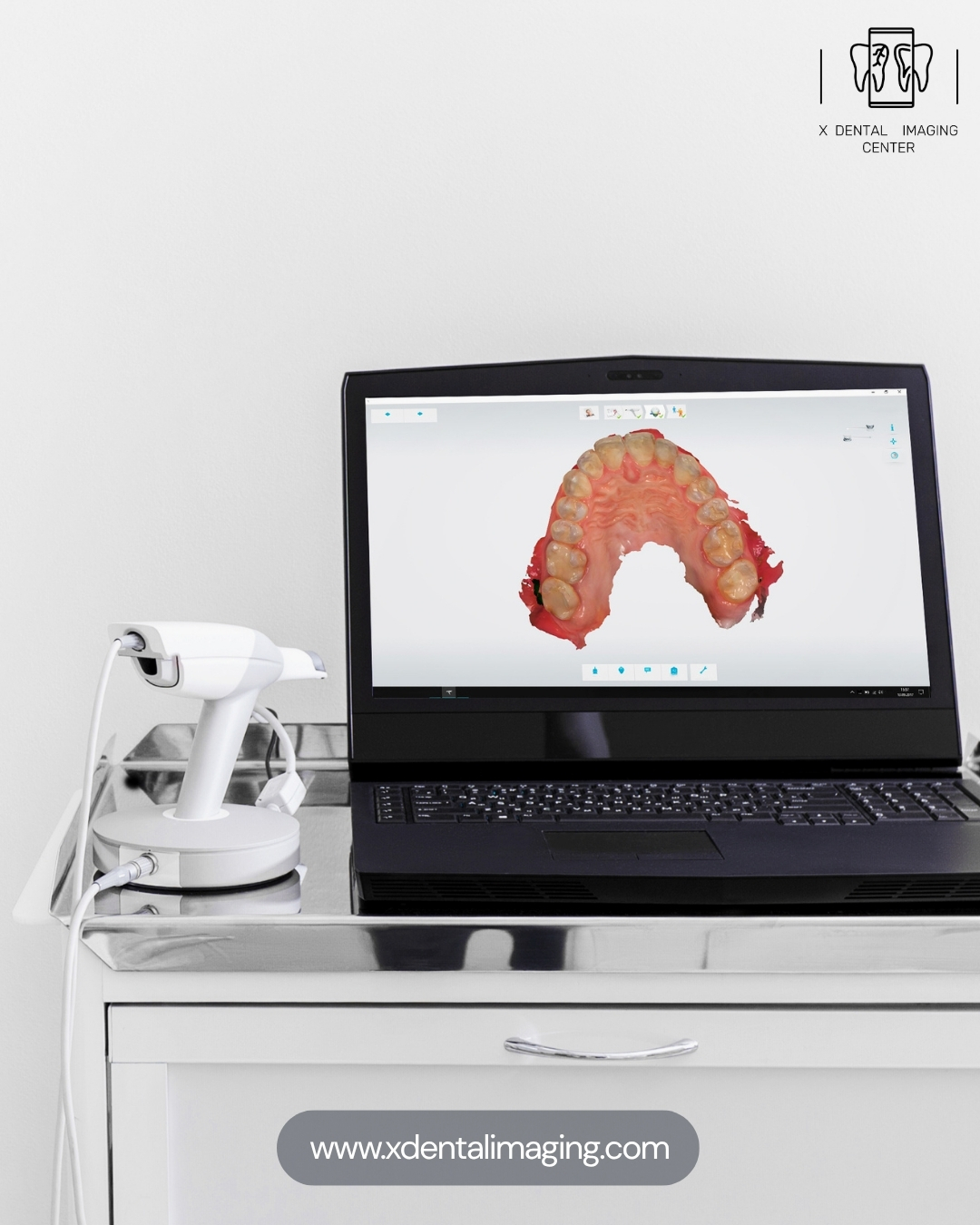 X Dental Imaging London: Setting a New Standard in CBCT, 3Shape & X-Ray ...